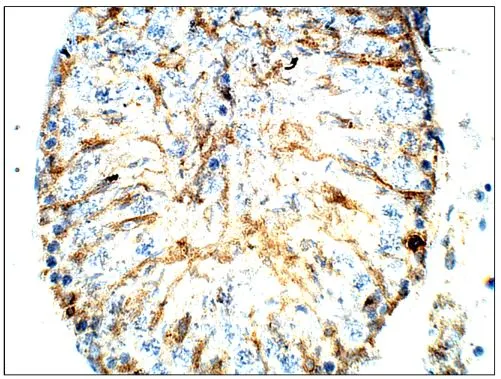 IHC-P analysis of rat testis tissue using GTX47811 CD317 antibody (C-terminal). Dilution : 1:100 IHC-P analysis of rat testis tissue using GTX47811 CD317 antibody (C-terminal). Dilution : 1:100