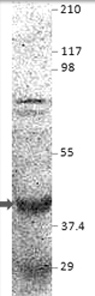 Western blot of Atrogin 1 using GTX47815 antibody. MW of Atrogin is 43kDa.