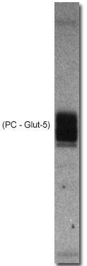 Western blot of Glut-5 using GTX47817 (1:500)