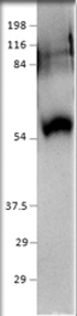 Western blot of SIDT1 using GTX47826. Antibody dilution 1:500 diluObuffer.