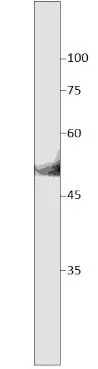WB analysis of mouse brain tissue lysate using GTX47873 SLC7A10 antibody (C-terminal). Dilution : 1:250 WB analysis of mouse brain tissue lysate using GTX47873 SLC7A10 antibody (C-terminal). Dilution : 1:250