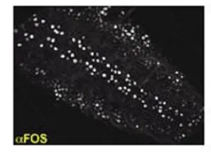 IHC analysis of 3rd instart ventral ganglion tissue using GTX47892 Drosophila Fos antibody. Dilution : 1:250 IHC analysis of 3rd instart ventral ganglion tissue using GTX47892 Drosophila Fos antibody. Dilution : 1:250