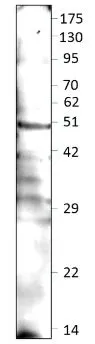 WB analysis of rat lung tissue extracts using GTX47896 DEK antibody. Dilution : 1:500