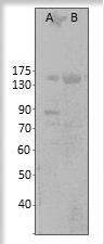 Western blot of c-Nucleotide gated channel beta1 using GTX47900 with MCF-7 cell lysate. Apparent MW of CNGb is 160kDa.