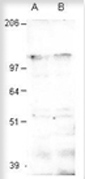 Western blot of binding protein Aquarius using GTX47913 antibody 1:500 in diluObuffer. Apparent MW of AQR is 140kDa.