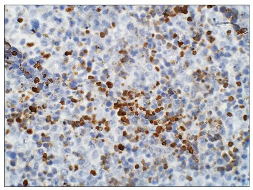IHC-P analysis of mouse embryo neonatal liver tissue using GTX47914 Aquarius antibody. Dilution : 1:50 IHC-P analysis of mouse embryo neonatal liver tissue using GTX47914 Aquarius antibody. Dilution : 1:50