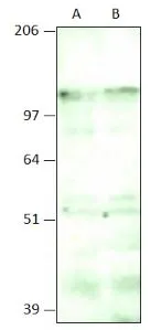 WB analysis of IBP160 recombinant protein (A) and PCI cell (B) lysates using GTX47914 Aquarius antibody. Dilution : 1:500