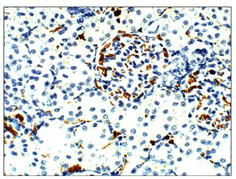 IHC-P analysis of rat kidney tissue using GTX47916 Aquaporin 9 antibody. Dilution : 1:100 IHC-P analysis of rat kidney tissue using GTX47916 Aquaporin 9 antibody. Dilution : 1:100
