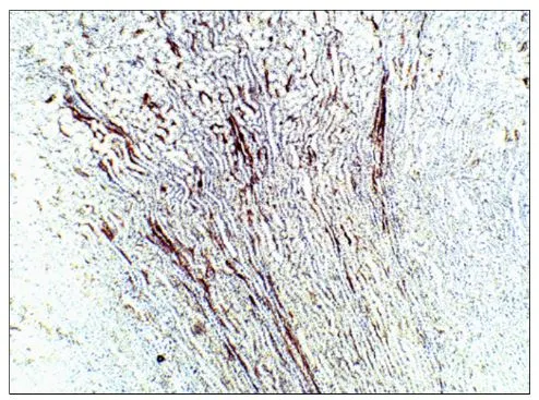 IHC-P analysis of rat kidney tissue using GTX47916 Aquaporin 9 antibody. Dilution : 1:100