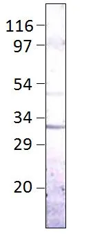 WB analysis of Aquaporin 9 recombinant protein using GTX47916 Aquaporin 9 antibody. Dilution : 1:500