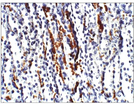 IHC-P analysis of rat kidney tissue using GTX47922 Aquaporin 3 antibody. Dilution : 1:100 IHC-P analysis of rat kidney tissue using GTX47922 Aquaporin 3 antibody. Dilution : 1:100