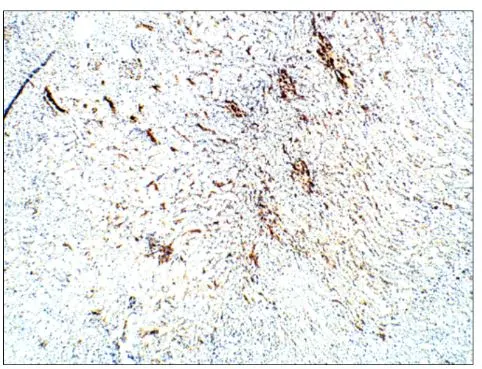 IHC-P analysis of rat kidney tissue using GTX47922 Aquaporin 3 antibody. Dilution : 1:100