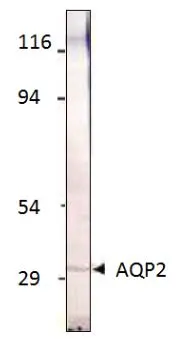 WB analysis of Aquaporin 2 recombinant protein using GTX47923 Aquaporin 2 antibody. Dilution : 1:500 WB analysis of Aquaporin 2 recombinant protein using GTX47923 Aquaporin 2 antibody. Dilution : 1:500