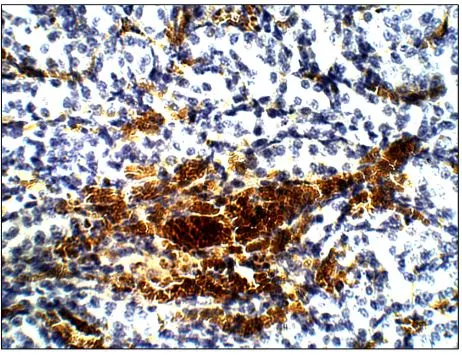 IHC-P analysis of rat kidney tissue using GTX47925 Aquaporin 12 antibody. Dilution : 1:100