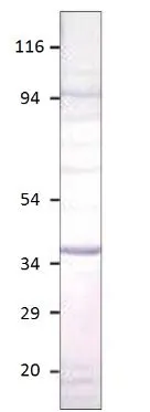 WB analysis of Aquaporin 12 recombinant protein using GTX47925 Aquaporin 12 antibody. Dilution : 1:500