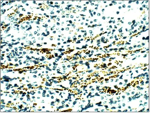 Rat Kidney- Aquaporin 11Primary Antibody: AQP11-GTX47927; 1:50 dilution in IHC Blocking Buffer.DAB (brown) staining and Hematoxylin QS (blue) counterstain.40x magnification. FFPE section.