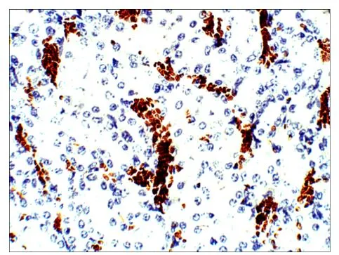 IHC-P analysis of rat kidney tissue using GTX47929 Aquaporin 10 antibody.<br>Dilution : 1:100