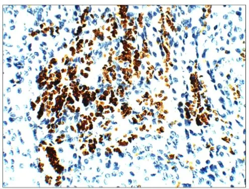 IHC-P analysis of rat kidney tissue using GTX47931 Aquaporin 1 antibody. Dilution : 1:100 IHC-P analysis of rat kidney tissue using GTX47931 Aquaporin 1 antibody. Dilution : 1:100