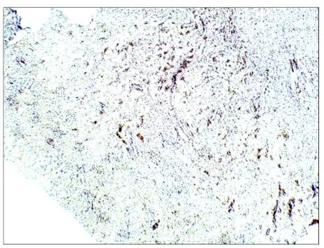 IHC-P analysis of rat kidney tissue using GTX47931 Aquaporin 1 antibody. Dilution : 1:100