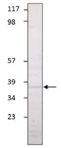Western blot analysis of Aquaporin 1 in human adult kidney tissue with Aquaporin 1 antibody (GTX47931) at a dilution of 1:500.