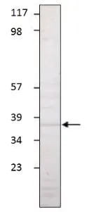WB analysis of Aquaporin 1 recombinant protein using GTX47931 Aquaporin 1 antibody. Dilution : 1:500
