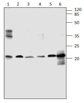 WB analysis of (1) Rat Hippocampus, (2) Rat Lung, (3) ARF4 recombinant protein, (4) Rat Spleen, (5) Rat Kidney lysates using GTX47932 ARF4 antibody. Dilution : 1:250 WB analysis of (1) Rat Hippocampus, (2) Rat Lung, (3) ARF4 recombinant protein, (4) Rat Spleen, (5) Rat Kidney lysates using GTX47932 ARF4 antibody. Dilution : 1:250