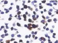 ICC/IF analysis of transfected cells using GTX47953 Renilla Luciferase antibody. ICC/IF analysis of transfected cells using GTX47953 Renilla Luciferase antibody.