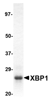 SDS-PAGE analysis of recombinant XBP1 on Coomassie Blue-stained 4-15% gradient gel.