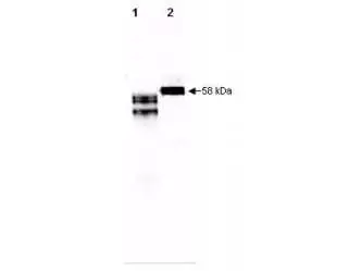 WB analysis of various samples using GTX48479 Fetuin A antibody. Lane 1 : Purified human fetuin A (250 ng) Lane 2 : Human serum (5 microL)
