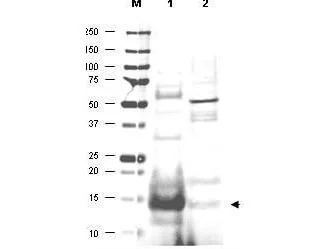WB analysis of various samples using GTX48485 UBE2N antibody. Lane 1 : Human small intestine tissue lysate Lane 2 : Mouse thymus tissue lysate Loading : 20 microg Dilution : 1:500 WB analysis of various samples using GTX48485 UBE2N antibody. Lane 1 : Human small intestine tissue lysate Lane 2 : Mouse thymus tissue lysate Loading : 20 microg Dilution : 1:500