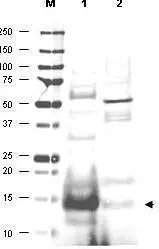 Western blot using GeneTexs affinity purified anti-UBC13 antibody shows detection of UBC13 protein in human small intestine lysate (lane 1) but not in mouse thymus lysate (lane 2). The heavily stained band in lane 1 (arrowhead) indicates this particular gel was overloaded with protein. The identity of minor reactive bands is unknown but could represent E2 complexes. Each lane contains approximately 20 microg of lysate. Primary antibody was used at a 1:500 dilution. The membrane was washed and reacted with a 1:10,000 dilution of Alexa FluorTM 680 conjugated rabbit anti-Goat IgG. Molecular weight estimation was made by comparison to prestained MW markers indicated at the left (lane M). Other detection systems will yield similar results.