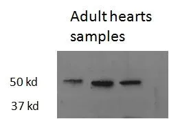 WB analysis of zebrafish adult heart lysate using GTX48511 Thrb antibody,Internal. Dilution : 2.5ug/ml Loading : 35ug protein in RIPA buffer
