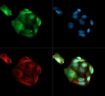 ICC/IF analysis of HepG2 cells using GTX48519 PSMD10 antibody. Green : primary antibody Red : Tubulin Blue : DAPI Dilution : 1:500