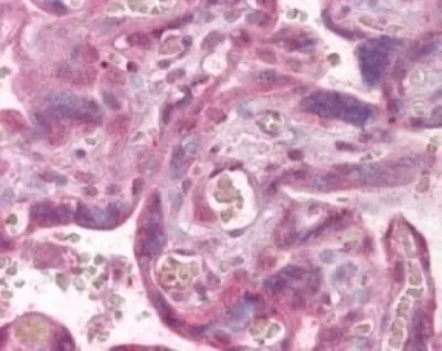 IHC-P analysis of human placenta tissue using GTX48549 PLK1 antibody. Dilution : 1:100