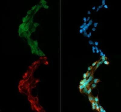 ICC/IF analysis of HEK293 cells using GTX48577 DGAT1 antibody. Green : primary antibody Red : Tubulin Blue : DAPI