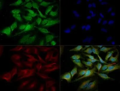 ICC/IF analysis of HeLa cells using GTX48583 ATG5 antibody. Green : primary antibody Red : Tubulin Blue : DAPI Dilution : 1:200 Fixation : 10% formalin Permibilization : 0.5% Triton-X100