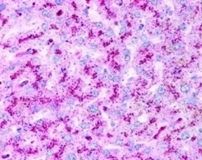 IHC-P analysis of human liver tissue using GTX48583 ATG5 antibody. Dilution : 2.5 microg/ml