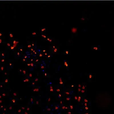 ICC/IF analysis of human iPS derived neuron cells using GTX48595 TDP43 antibody (DyLight 550). Red : primary antibody Blue : DAPI Dilution : 1:200 Permibilization : 0.3% Triton X-100 Fixation : 4% PFA ICC/IF analysis of human iPS derived neuron cells using GTX48595 TDP43 antibody (DyLight 550). Red : primary antibody Blue : DAPI Dilution : 1:200 Permibilization : 0.3% Triton X-100 Fixation : 4% PFA