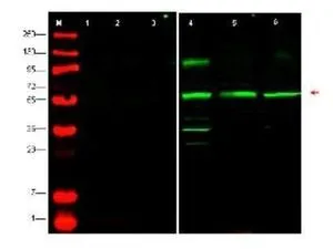 WB analysis of HeLa (lane 4), HEK293 (lane 5) and MCF-7 (lane 6) cell lysate using GTX48598 PTENP1 antibody. Lanes 1-3 were show the results of staining after the antibody was first pre-incubated with the immunizing peptide. Dilution : 1:500 WB analysis of HeLa (lane 4), HEK293 (lane 5) and MCF-7 (lane 6) cell lysate using GTX48598 PTENP1 antibody. Lanes 1-3 were show the results of staining after the antibody was first pre-incubated with the immunizing peptide. Dilution : 1:500