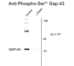 Western blot of rat cortex lysate showing specific immunolabeling of the ~50k Gap-43 protein phosphorylated at Ser41 (Control). The phosphospecificity of this labeling is shown in the second lane (lambda-phosphatase: lambda-Ptase). Western blot of rat cortex lysate showing specific immunolabeling of the ~50k Gap-43 protein phosphorylated at Ser41 (Control). The phosphospecificity of this labeling is shown in the second lane (lambda-phosphatase: lambda-Ptase).