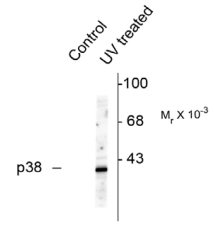 Western blot of HeLa cell lysates that had been treated with UV or untreated (Control) showing specific immunolabeling of the ~39k p38 MAPK protein phosphorylated at Thr180/Tyr182 using p38 MAPK (phospho Thr180/Tyr182) antibody (GTX48614)