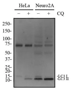 WB analysis of HeLa and Neuro2a cells treated with or without 50 uM chloroquine(CQ) for 24 hours using GTX48634 LC3A antibody. Dilution : 2 microg/ml WB analysis of HeLa and Neuro2a cells treated with or without 50 uM chloroquine(CQ) for 24 hours using GTX48634 LC3A antibody. Dilution : 2 microg/ml