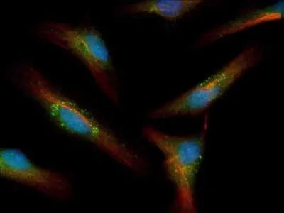 ICC/IF analysis of HeLa cells treated with 50uM chloroquine using GTX48634 LC3A antibody. Green : primary antibody Red : Tubulin Blue : DAPI