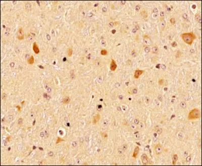 IHC-P analysis of mouse brain tissue using GTX48634 LC3A antibody. Dilution : 1:300