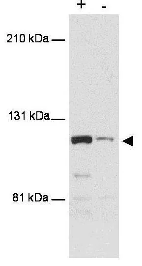 Western blot using GeneTex's anti-MTBP antibody shows detection of a band 110 kDa corresponding to human MTBP (arrowhead).