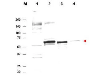 WB analysis of various samples using GTX48651 AKT antibody. Lane 1 : HeLa whole cell lysate Lane 2 : H2O2-treated MCF-7 whole cell lysate Lane 3 : Recombinant AKT protein Lane 4 : A431 whole cell lysate Loading : 35 microg Dilution : 1:300