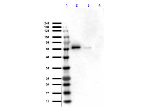 WB analysis of various samples using GTX48651 AKT antibody. Lane 1 : Protein ladder Lane 2 : Recombinant AKT1 protein Lane 3 : Recombinant AKT2 protein Lane 3 : Recombinant AKT3 protein Loading : 50 ng Dilution : 1:1000