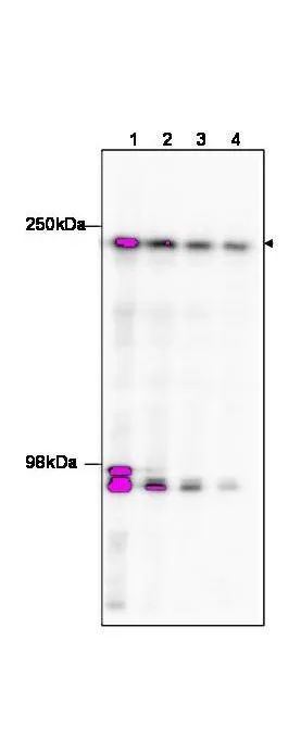 Transcription Initiation Factor TFIID Subunit 1 (TAF1) antibody (GTX48659) was used to detect TAF1 in treated and untreated HeLa Cells.