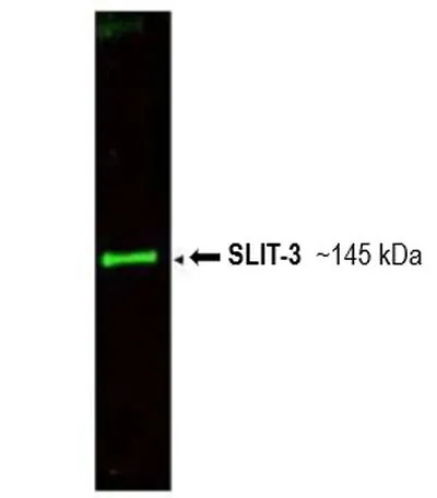 WB analysis of bovine thyroid whole cell lysate using GTX48660 SLIT3 antibody. Dilution : 1:800 Loading : 35microg WB analysis of bovine thyroid whole cell lysate using GTX48660 SLIT3 antibody. Dilution : 1:800 Loading : 35microg