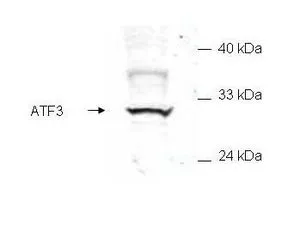 Western blot of mammalian whole cell extract transfected with HA epitope tagged human ATF3. GeneTexs Affinity purified anti-ATF3 detects a band ~31 kDa corresponding to recombinant human ATF3. Immunostaining using GeneTexs anti-HA epitope tag antibody confirms the composition of the recombinant band (not shown). The protein was transferred to nitrocellulose in 30 minutes using standard methods. After blocking with 5% goat serum and 0.5% non-fat milk in PBS, the membrane was probed with the primary antibody diluted 1:200 in 0.2X blocking buffer in PBS overnight at 4oC. Reaction was followed by washes and reaction with a 1:5000 dilution of IRDye?800 conjugated Gt-a-Rabbit IgG [H&L] for 30 min at room temperature. LICORs OdysseyR Infrared Imaging System was used to scan and process the image. Other detection systems will yield similar results.